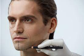 Chirurgie Esthétique pour Hommes à lyon